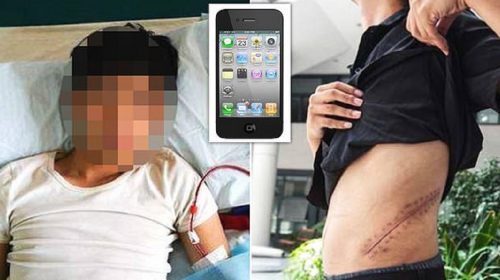 Πούλησε το νεφρό του για να αγοράσει iPhone και τώρα έμεινε κατάκοιτος με νεφρική ανεπάρκεια