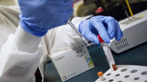 Δύο ακόμα νεκροί από τη γρίπη Α στην Κύπρο