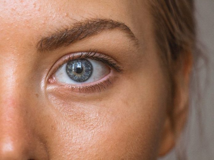 3 tips για να απαλλαγείς από τα σημάδια ακμής (μια και καλή!) 3 tips για να απαλλαγείς από τα σημάδια ακμής (μια και καλή!)