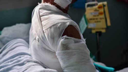 Τη βίασε, πήγε να την κάψει και εκείνη τον τράβηξε μαζί της στη φωτιά