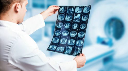 Λογισμικό αλλοιώνει τις μαγνητικές και εμφανίζει ανύπαρκτους καρκινικούς όγκους