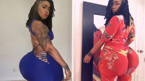 «Η τριπλή αυξητική γλουτών ήταν πολύ μεγάλο λάθος»