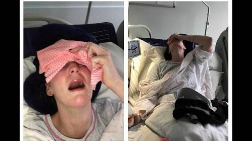 Η γυναίκα με το χειρότερο πόνο στην ιατρική κινδυνεύει από εσωτερικό αποκεφαλισμό