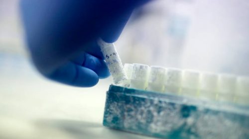 Γιατρός χρησιμοποιούσε το δικό του σπέρμα σε εξωσωματικές εν αγνοία των ασθενών