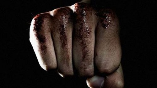 Έσπασε ποτήρι κρασιού στο πρόσωπο πελάτη σε μπαρ για μια γυναίκα