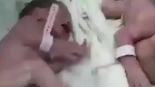 Δίδυμα γεννήθηκαν 20 λεπτά μετά τον σεισμό στην Αλβανία