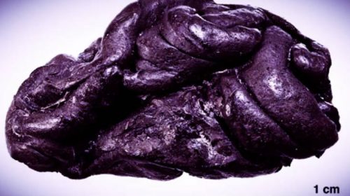 Επιστήμονες ανακάλυψαν ανθρώπινο DNA πάνω σε μια… τσίχλα 5.700 ετών