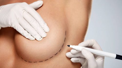 Ήθελε μεγαλύτερα στήθη, την πετσόκοψαν και τελικά τα αφαίρεσε και τα δύο