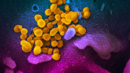 Κορονοϊός: Πάνω από 70 φαρμακευτικές ουσίες βρίσκονται υπό δοκιμή