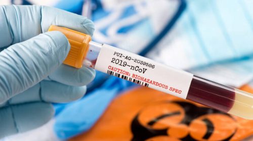 Κορονοϊός: Θετική γυναίκα στη Γεωργία που είχε πάει σε μνημόσυνο με δεκάδες ανθρώπους