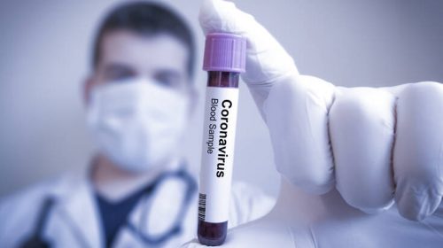 Πρώτος θάνατος από τον κορονοϊό στο Μεξικό