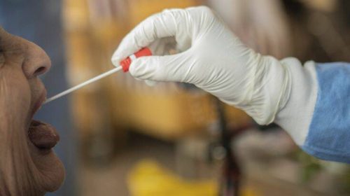 Έρευνα για πιθανή απόκρυψη θανάτων λόγω κορονοϊού στο μεγαλύτερο γηροκομείο της Ιταλίας