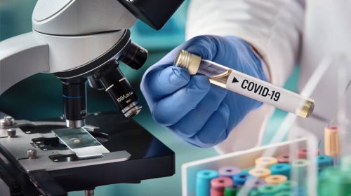 Κορονοϊός: Ο περιορισμός κυκλοφορίας των πολιτών μπορεί να διαρκέσει έως 3 μήνες στην Πορτογαλία