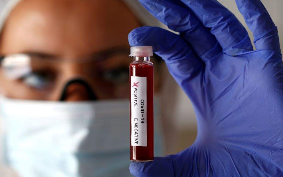 Covid-19: Αυτές οι ομάδες αίματος κινδυνεύουν περισσότερο Covid-19: Αυτές οι ομάδες αίματος κινδυνεύουν περισσότερο
