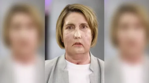 Πήρε καινούργιο πρόσωπο από δωρήτρια που επέλεξε την ευθανασία